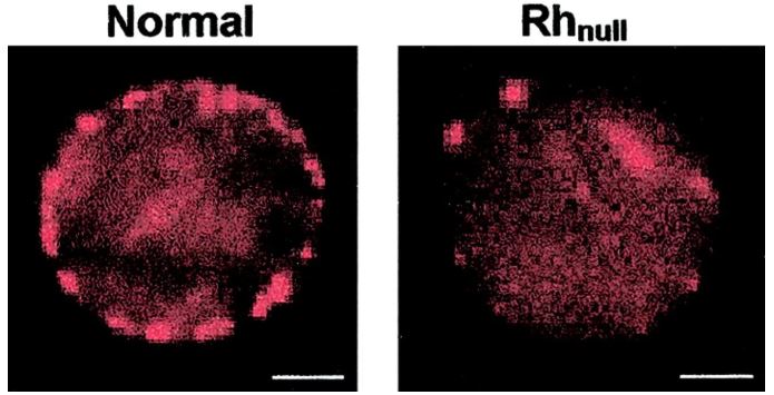 Rare Genetic Traits Most People Probably Don’t Have