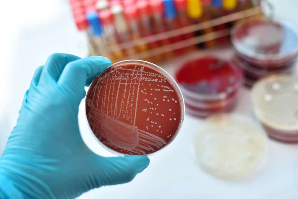 Scary Facts About Antibiotic-Resistant Superbugs